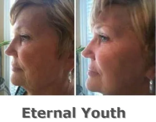 Гиалуроновая кислота 1 кг л антивозрастное средство HA для ухода за кожей лица и