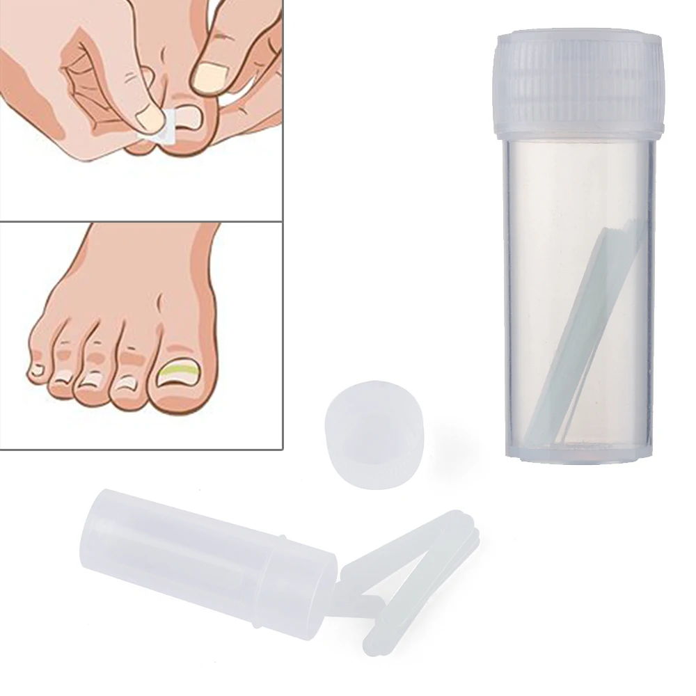 

10pcs Toe Nail Ingrown Correction Sticker Fixer Patch Foot Care Paronychia Correction File Elastic Patch Corrector Treatment