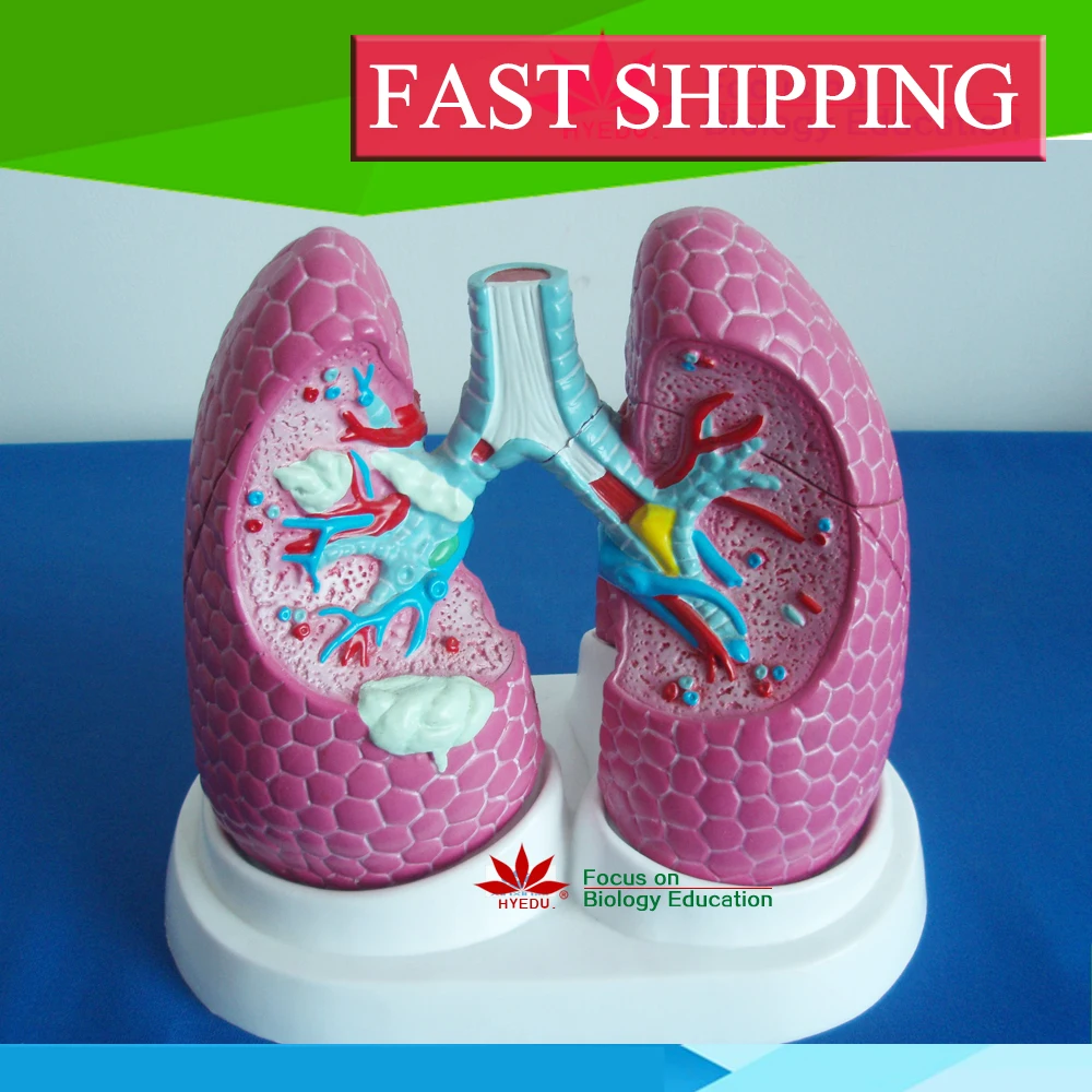 Limited time offer Anatomy biological Bronchus and lung pathology model