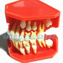 Dental Children Deciduous Teeth Model Replacement Model Permanent Teeth Alternate Display Removable Demonstration for Teaching Dental Children Deciduous Teeth Model Replacement Model Permanent Teeth Alternate Display Removable Demonstration for Teaching