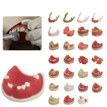 Стоматологические материалы, Стоматологическая модель, хирургический имплантат для полости рта, зубные Принадлежности, инструменты, мягкие десны