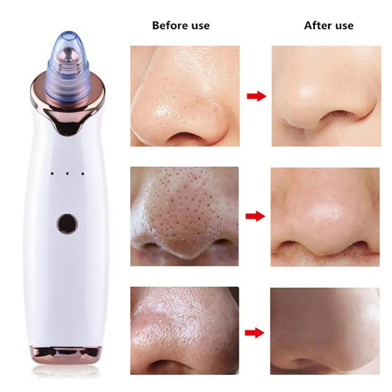 

Electric Blackhead Remover Skin Care Pore Vacuum Acne Pimple Removal Vacuum Suction Tools Facial Diamond Dermabrasion Machine