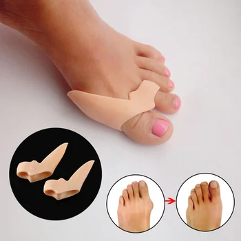 

200Pcs Genuine New Special Hallux Valgus Bicyclic Thumb Orthopedic Braces to Correct Orthotics Daily Silicone Toe Big Bone