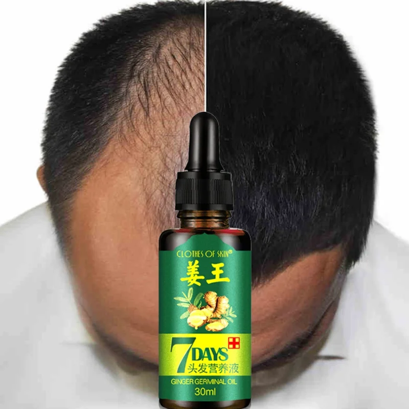 Ginger Essence Hairdressing Hairs Mask Hair Essential Oil Hair Care Oil Essential Oil Dry and Damaged Hairs Nutrition