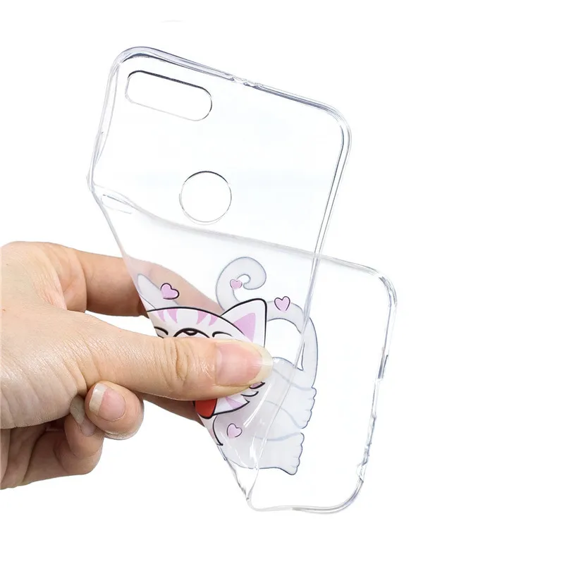 For Xiaomi Mi 5X Mi A1 Case (5)