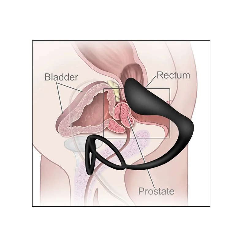 Silicone-Male-masturbator-Prostate-Massage-Anal-plug-stimulator-Butt-Plug-Sex-Toys-for-Men-Cock-Ring (3)