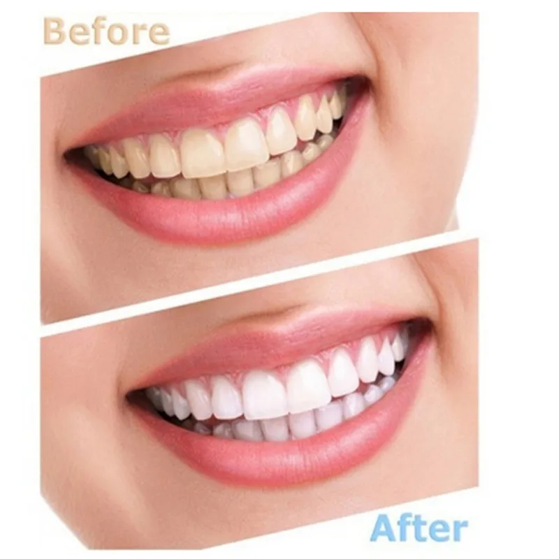 Teeth Whitening Remove Stains Agent Oral Hygiene Dental Care Beauty Teeth Cold Light Hot Sale Teeth Whitening Gel