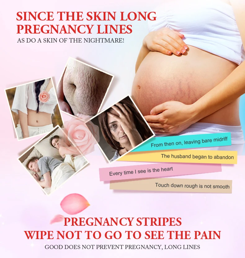 Creme de Pele para Estrias Remoção da Cicatriz para Reparação da Pele Dropshipping Suave Maternidade Creme Corporal Remover Cicatriz Pós-parto 10 Pçs 4 Cheap Maternidade