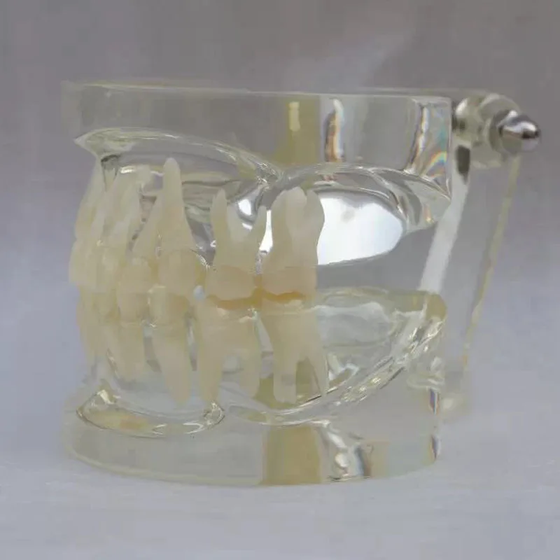 

Clear primary dentition model baby teeth model