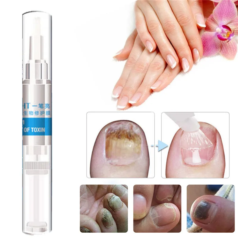 4pcs Nail Fungal Treatment Pen Anti Fungus Infection Biological Repair