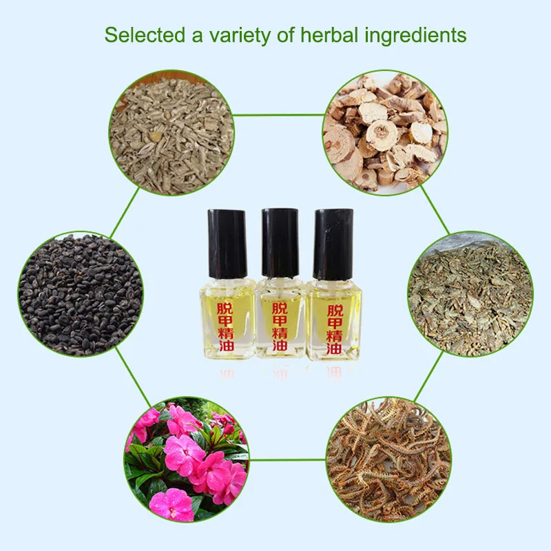 

Toenails Remove Essential Oil Damaged Toenails Softening for Ringworm Treatment Fungus Onychomycosis JIU55