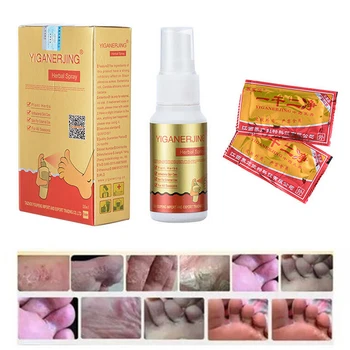 

30ml/bottle Natural Foot Spray Eczema Psoriasis Rosacea Pruritus Skin Chinese Herbal Feet Spray