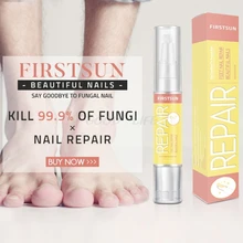 4 мл травяная инфекция ногтей Лечение ручка питательный раствор удаляет онихомикоз параониксия противогрибковые биологические восстанавливающая жидкость