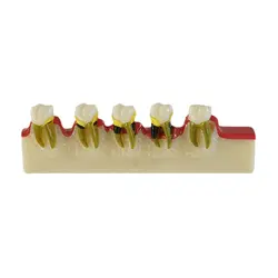 Зубные лаборатории peridontal заболеваний разработки модель для стоматологической преподавания