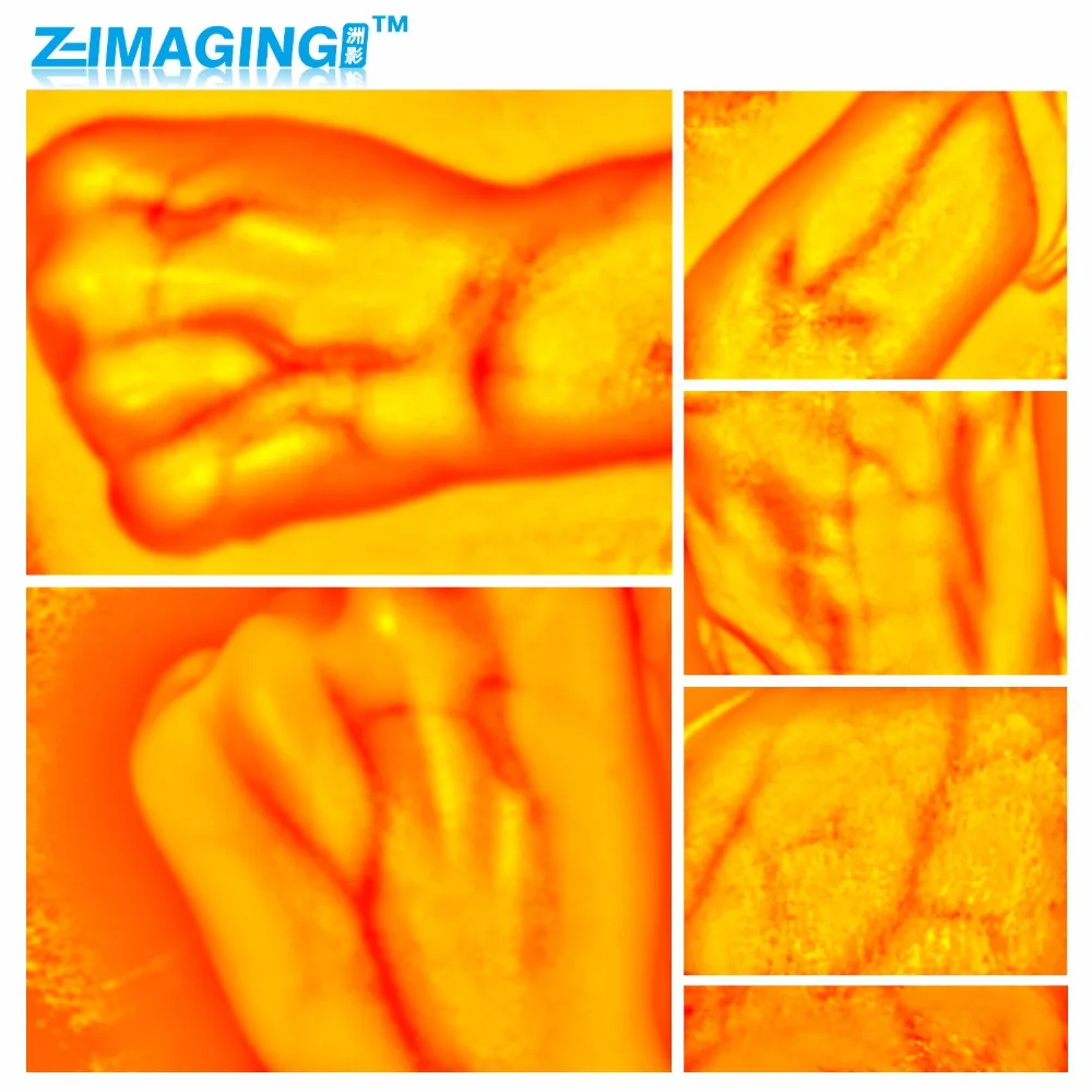 

2016 New Adults And Children Suitable Vein Viewer Display Lights Imaging Find Vein Medical Vein Finder Vein Viewer