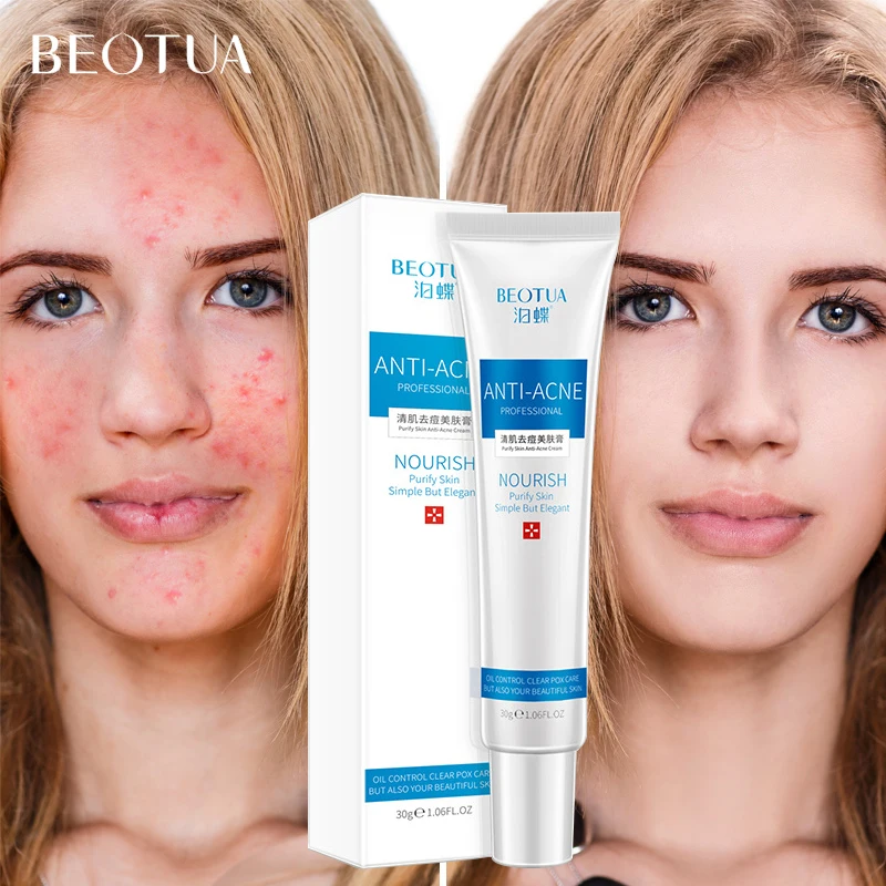 

BEOTUA Tea Tree Acne Face Cream Anti Acne Treatment Shrink Pores Collagen Scar Removal Whitening Hyaluronic acid Moisturizing