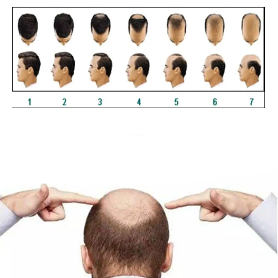 Polygonum Multiflorum White Hair Barba Black And Grow Growth