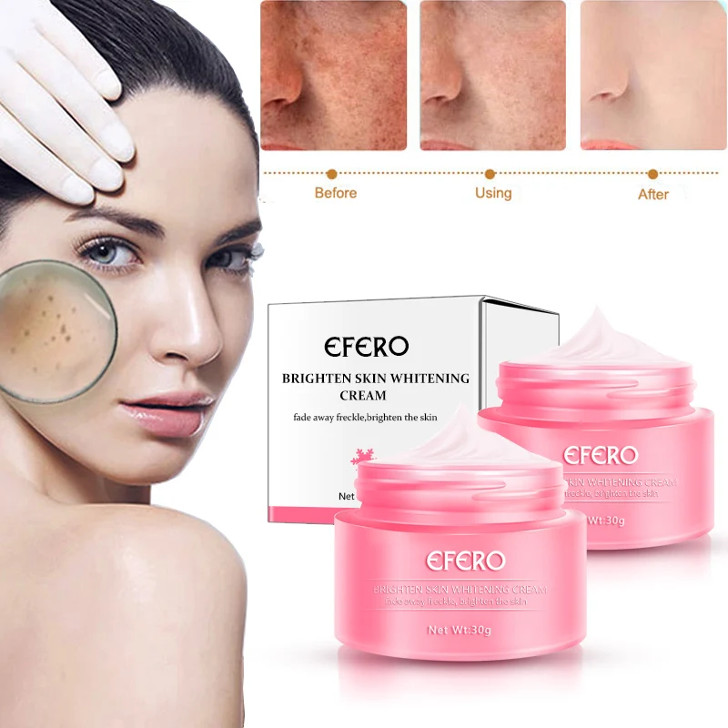 EFERO отбеливающий крем веснушки крем пигментация Melasma удаление Осветление кожи для темных пятен Manchas для удаления кремов для лица