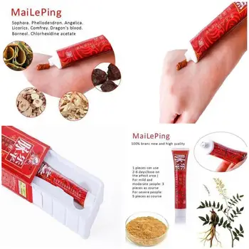 

Varicose Veins Cream Relief Phlebitis Angiitis Inflammation Blood Vessel Health Care TK-ing