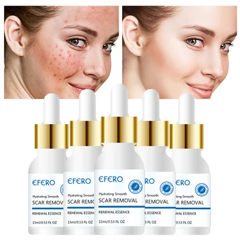 

EFERO Face Serum Acne Removal Hyaluronic Acid Skin Care Moisturizing Wrinkle Anti Aging Serum Face Whitening Cream Essence