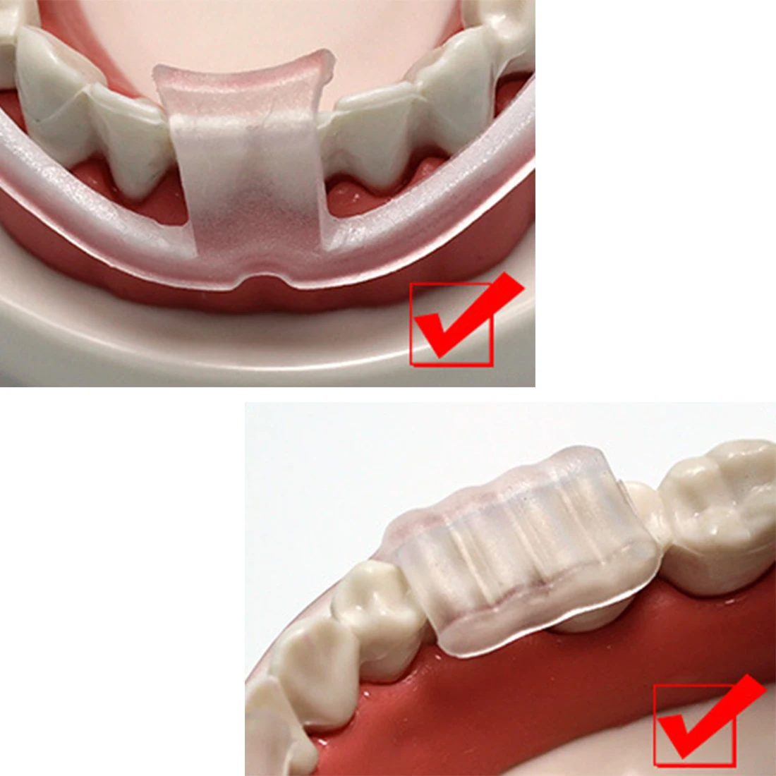 

Soft Clear Silicone Tooth Correction Tool Dental Brace Teeth Grinding Prevention Bruxism Sleeping Aid Tool