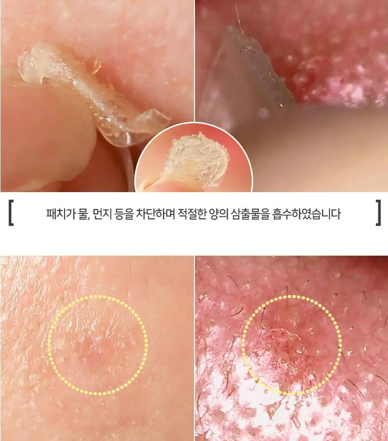 ELIZAVECCA ведьма Копилка Hell Pore пятна пятно патч 44 шт маска для лица шрам ремонт прыщей