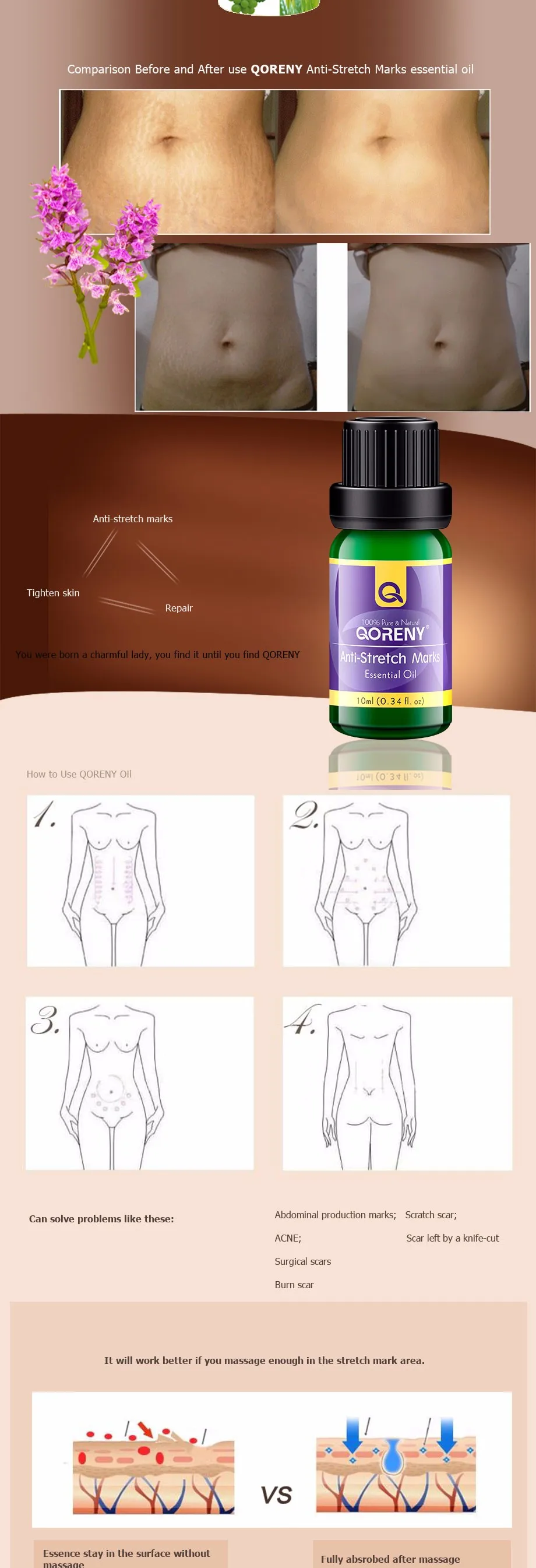 anti-stretch-marks-essential-oil_03