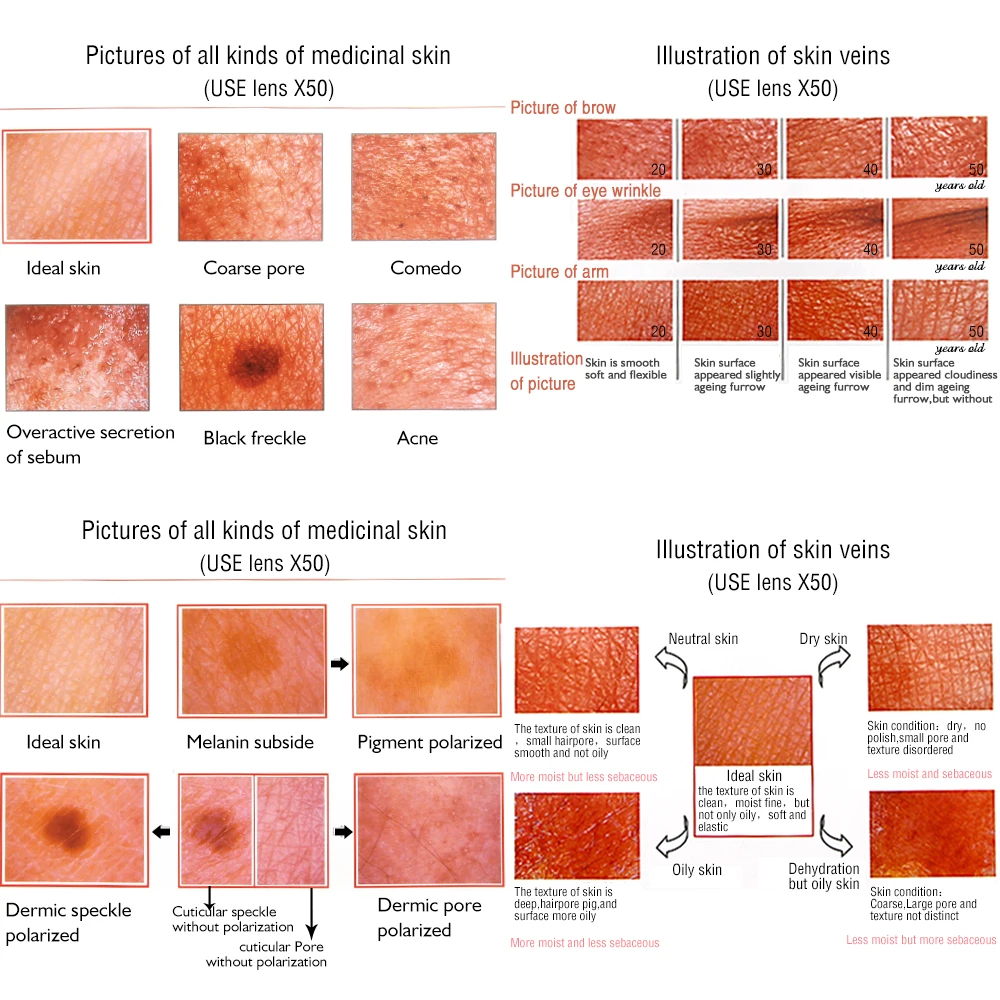 Уход за кожей 5,0 МП HD USB 3D область применения кожи диагностический анализатор увлажнение кожи на лице масло акне тестер метр анализ Красота Инструменты