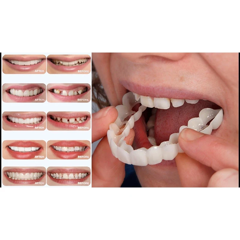 

BellyLady Snap On Smile Teeth Perfect Smile Comfort Fit Flex Teeth Fits veneers smile Denture Whitening