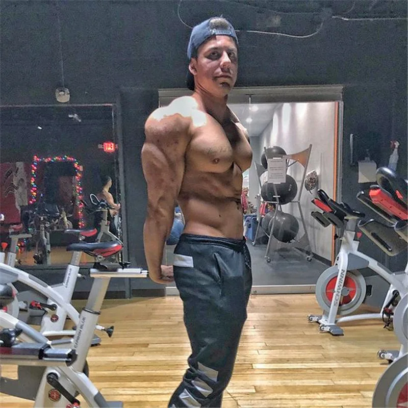 31