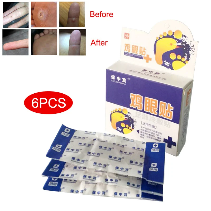

6 Pcs Exfoliating Corn Foot Patch Feet Dead Skin Remove Treatment Foot Plantar Warts Calluses Away WS99