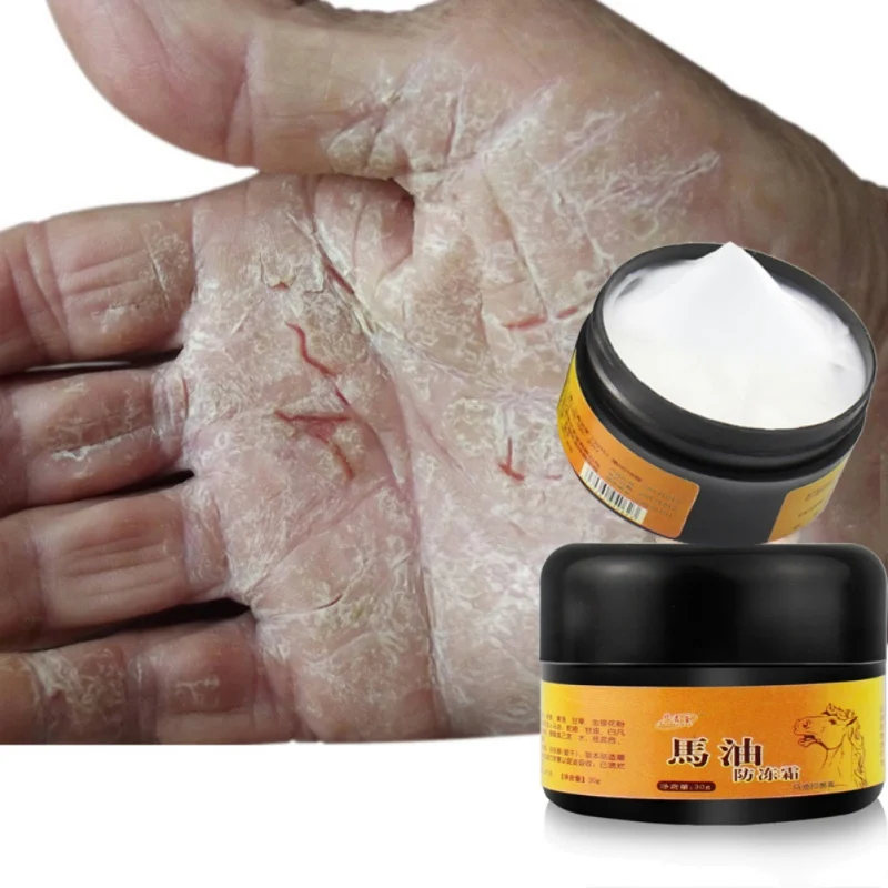 Лошадиное масло для ног антифриз крем лечение сухой кожи пятки обветренный пилинг ремонт уход за кожей ног