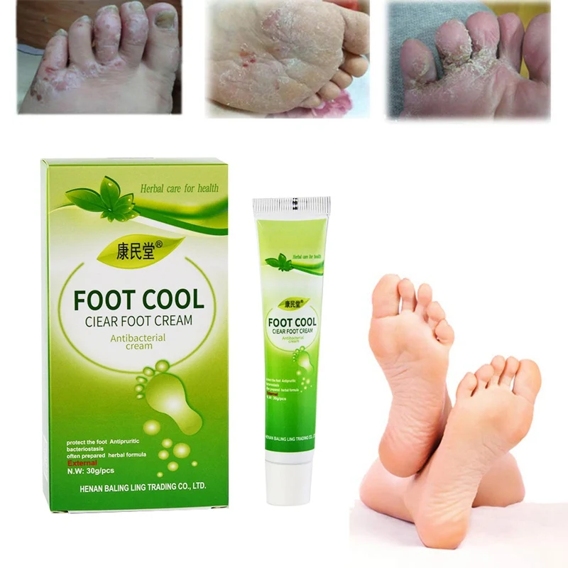 

Natural Foot Care Cream Antibacterial Anti Itch Sweat Odor Feet Anti-fungi Cream