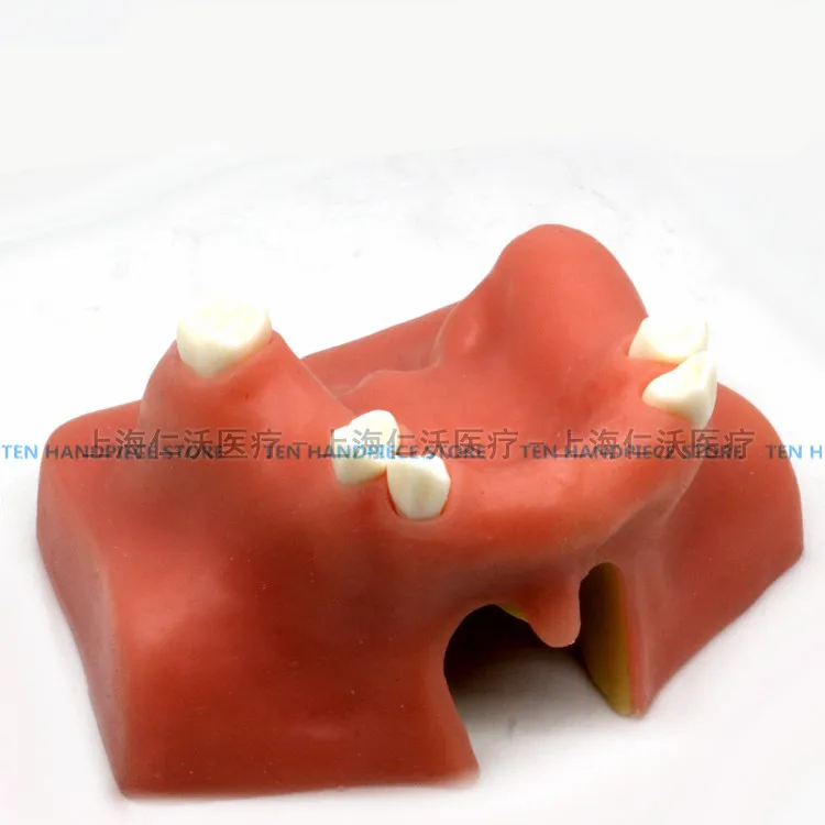 Хорошее качество зубной имплантат тренировочная модель оральный имплантат тренировочная модель максиллярная синусовая гимнастика