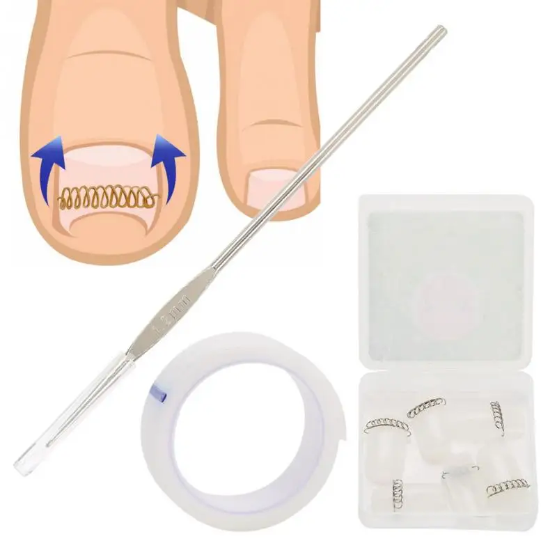 

3 in1 Foot Care Toe Corrector Nail Fixer Pedicure Toenail Recover Correction Wire Tool Treatment Crochet Hook Nail Foot Care Kit