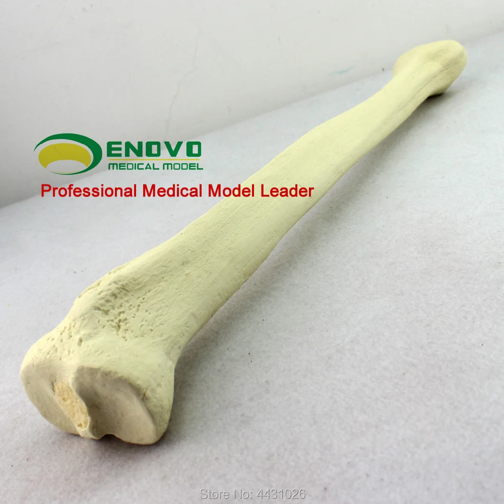 ENOVO Bone implant simulation bone of the bone of the bone model of Sawbone before orthopedic surgery ENOVO Bone implant simulation bone of the bone of the bone model of Sawbone before orthopedic surgery