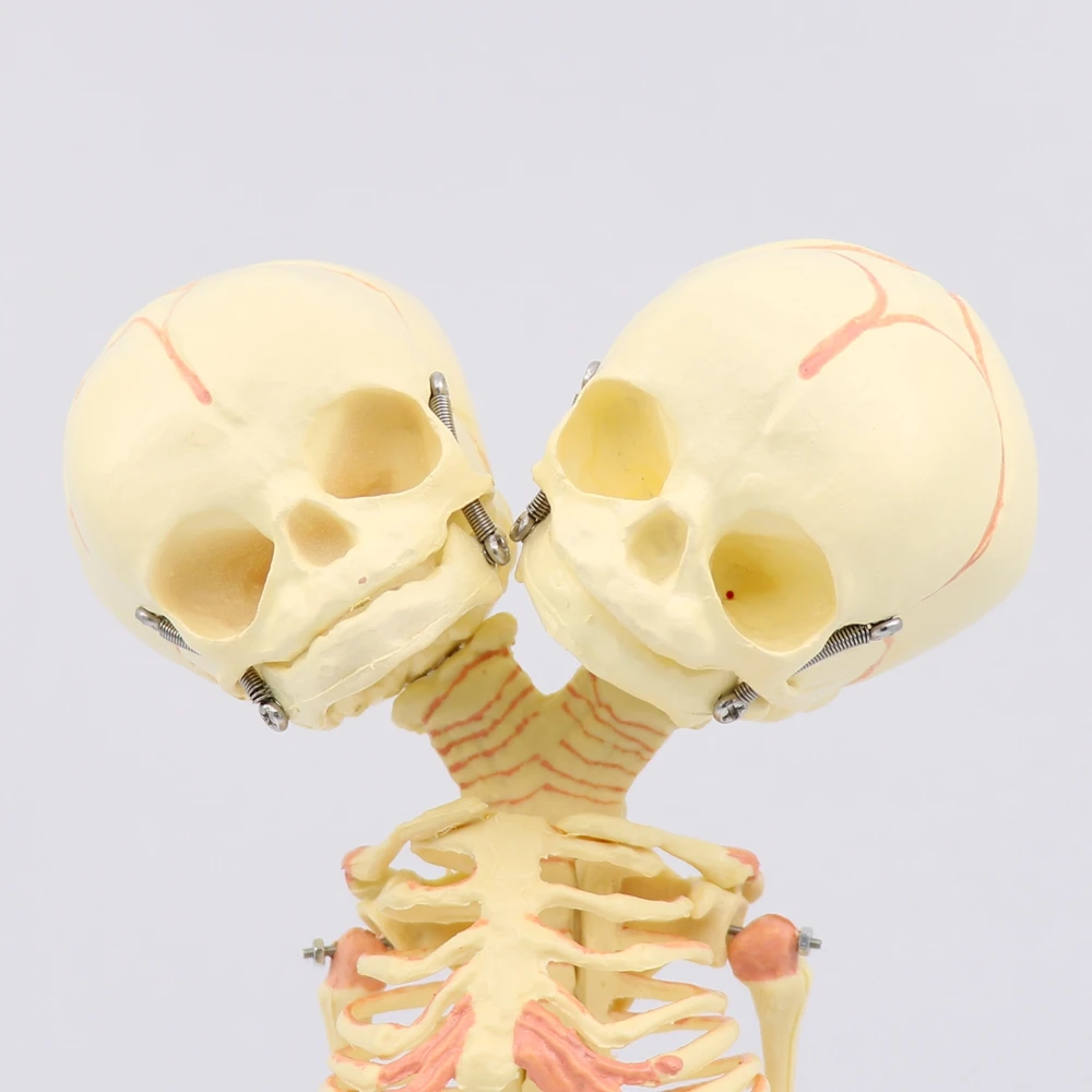 35 см двуглавый Череп Человек Новорожденный ребенок двойная Голова Череп для изучения анатомии Скелет анатомический мозг образование анатомическая модель исследования