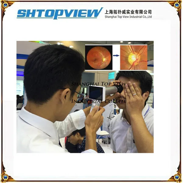 2017 new product Non-mydriatic eye fundus camera