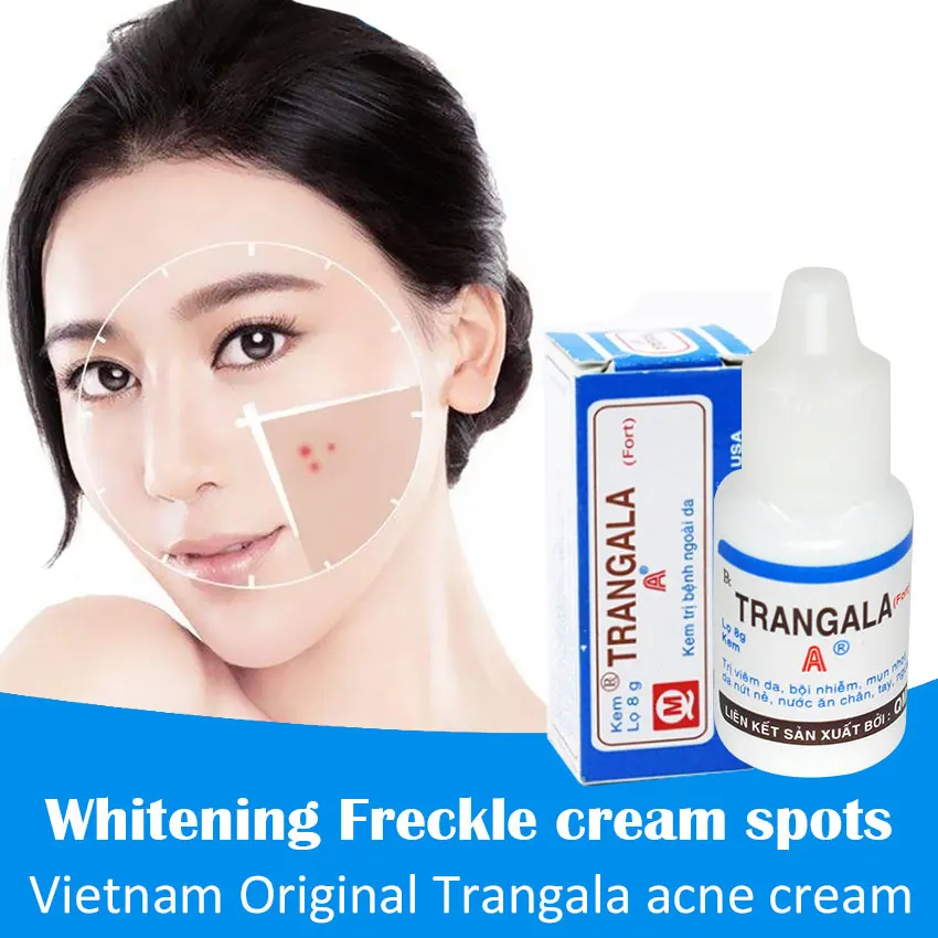 Vietnam Original 8g Anti Acne Cream / Oil Control / Shrink Pores/ Acne