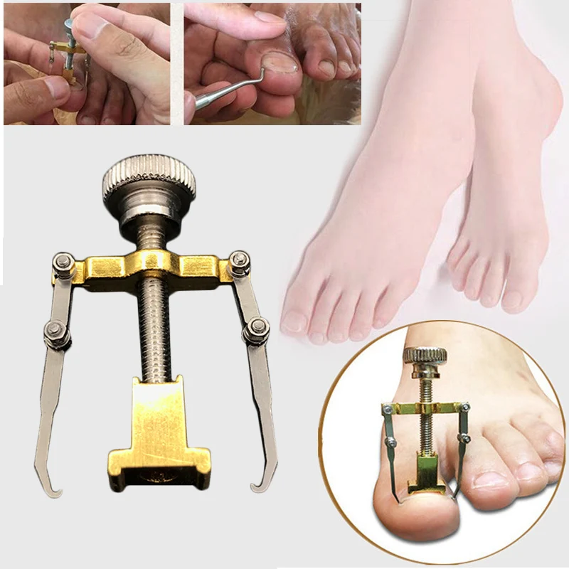 

Ingrown Toenails Pedicure Foot Nail Care Tools File for Feet Orthotic Acronyx Ingrowing Nail Onyxis Bunion Corrector Massage