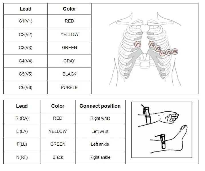 Совместимый martara H3 5 leads holter ECG cable, snap, IEC, TPU