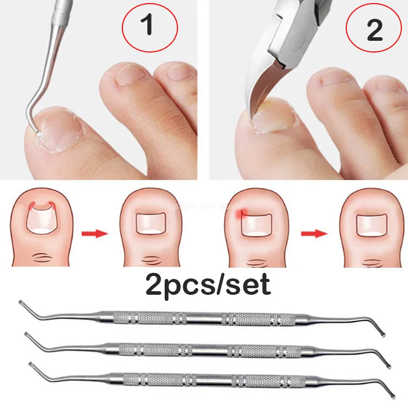 2 шт./компл. вросшие ногти, забота о ногах, инструмент ног Коррекция ногтей кусачки для стрижки фрезы, удаляет мертвую кожу для удаления грязи+ паронихии Подиатрия для педикюра