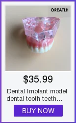 Зубные имплантат Обучение Модель челюсти с мягкой ткани для имплантат исследование