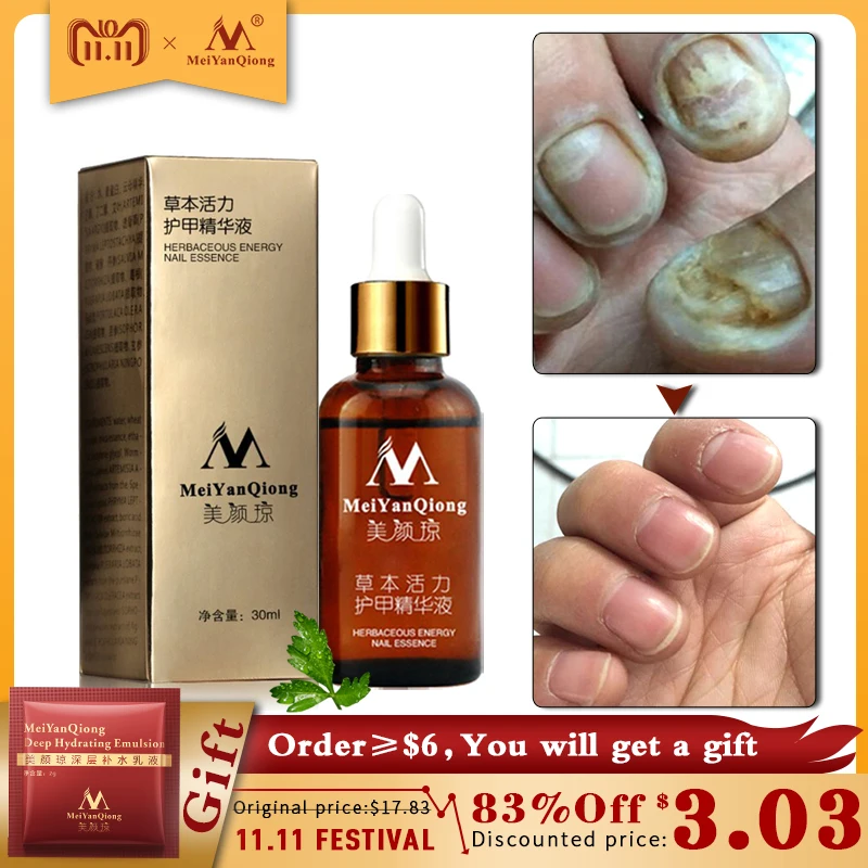 Buy Fungal Nail Treatment Feet Care Essence Nail Foot