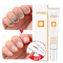 Nail Fungus Cream Remover Feet Care Essence Whitening Toe From Nail Foot Fungus Remove Gel Antifungal Onychomycosis Cream EFERO antibacterial and antifungal lectins from leguminous plants