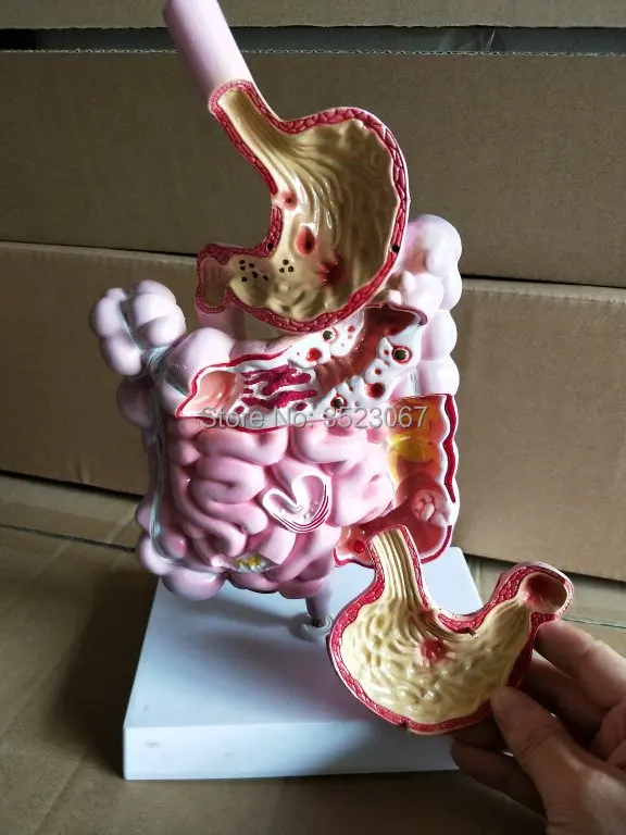 TB2_LN3d6oIL1JjSZFyXXbFBpXa_!!59209307