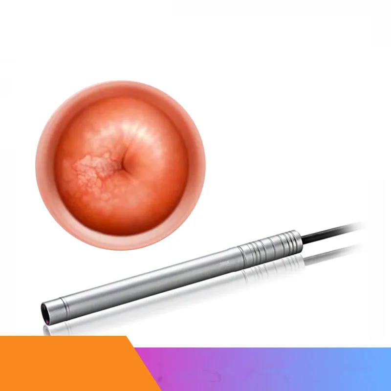 Digital colposcope Gynecological self-examination mirror Peeping Detector Cervical checker voyeurism Endoscope | Инструменты