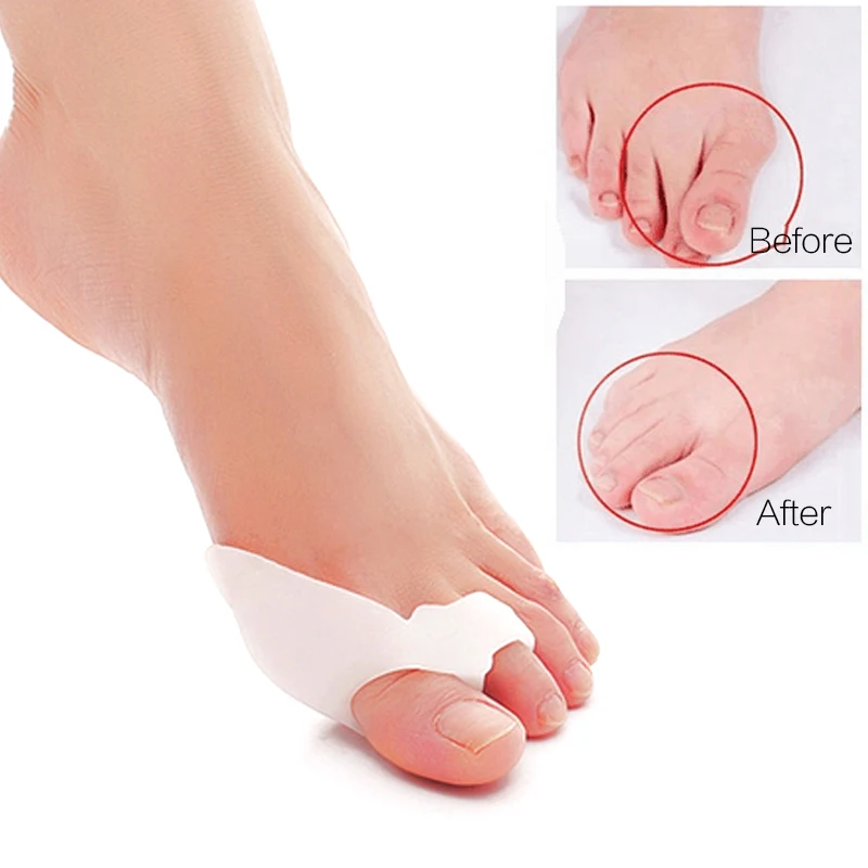 

1pair Toe Separator Hallux Valgus Corrector Silicone Orthopedic Mats Big Toe Separator Thumb Bunion Corrector Pedicure Foot Care