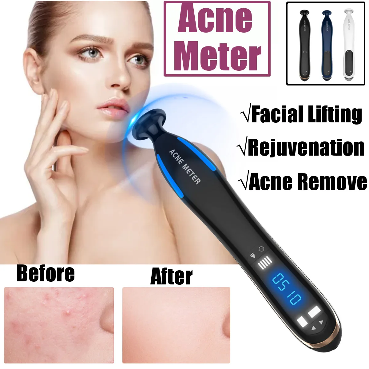 

Blue Light Plasma Pen Scar Acne Removal Anti Wrinkle Aging Therapy Acne Treatment Pen Beauty Device Facial Skin Care Machine