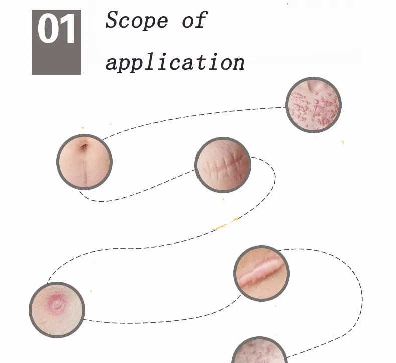 3,5*12 см 1 шт органический силиконовый гель шрам терапия патч быть мыть и повторно использовать